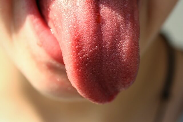 wat laat jouw tong zien